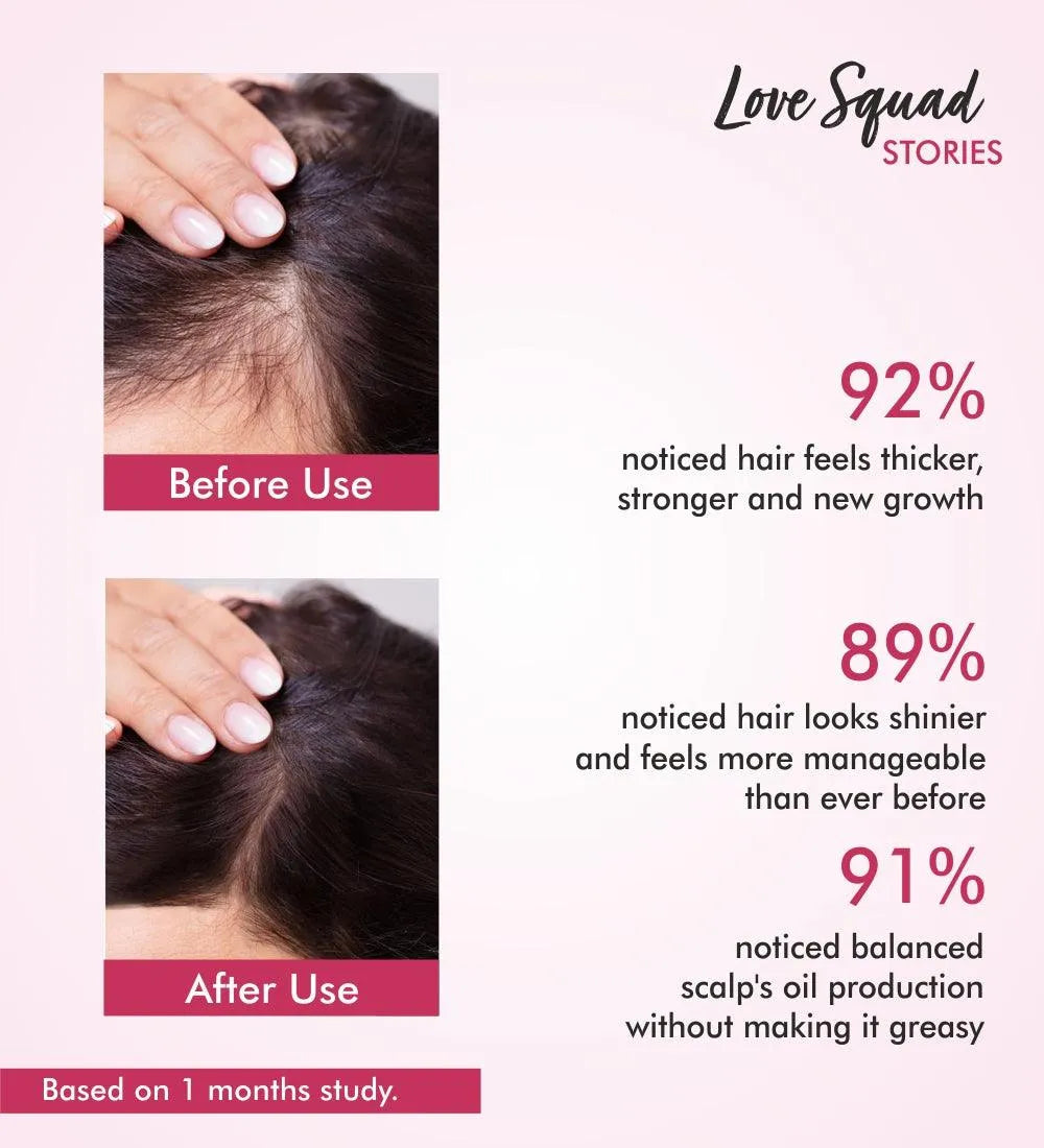 Onion Hair Fall Oil - The Love Co