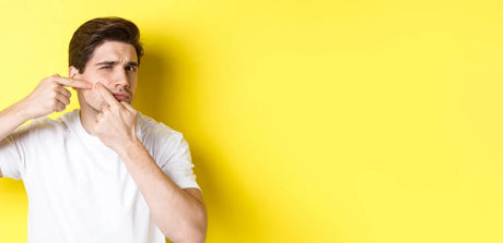 Man in white t-shirt popping pimple on face, yellow background, acne skincare concept