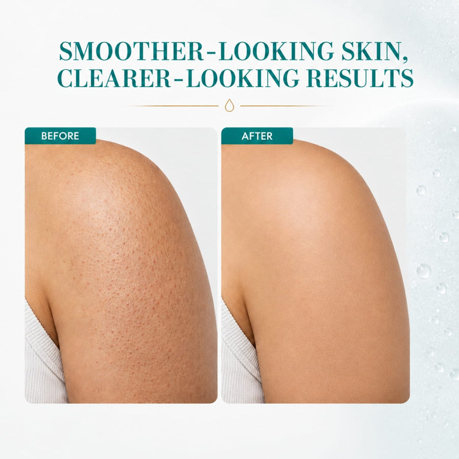 1% Salicylic Acid Body Wash